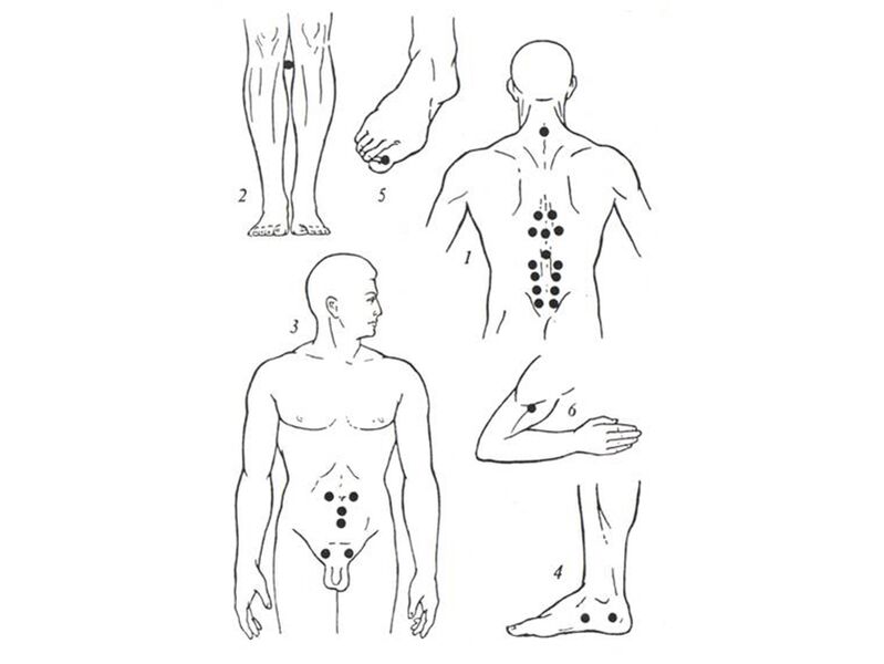 Akupunikura massage