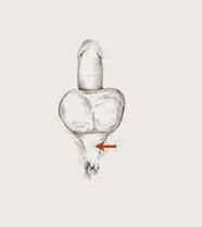 potential muscles and their tension ponso